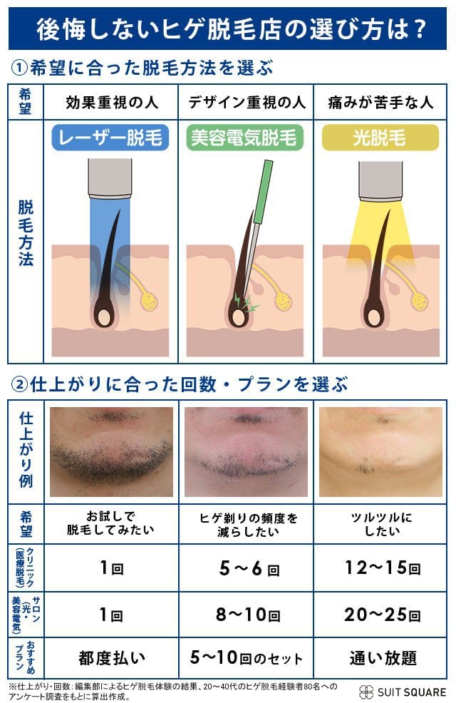 後悔しないひげ脱毛店の選び方,1希望に合った「脱毛方法」を選ぶ,2仕上がりに合った「回数・プラン」を選ぶ